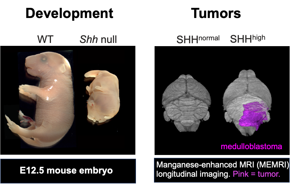 HH signaling in development and disease